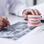 インプラントが難しい場合