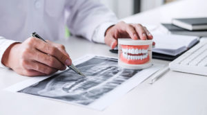 インプラントが難しい場合