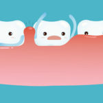 歯を失う原因になる歯周病