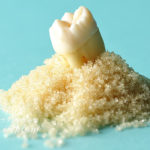 骨粗鬆症でもインプラントは可能か