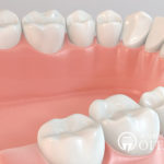 歯科技工士の役割