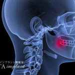 原因不明の歯の痛み